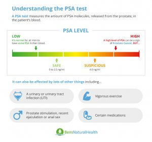 What is the PSA Level for Prostate Cancer? | Elevated PSA Levels