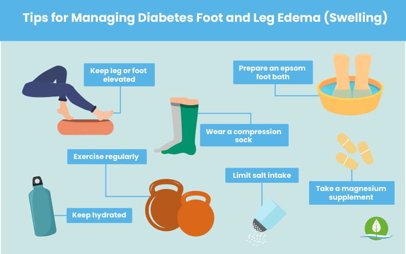 Diabetes Swollen Feet How To Treat Swelling In The Legs 2023 