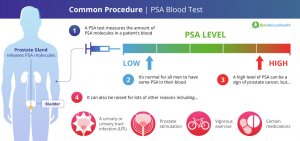 How To Lower Your PSA Level Safely And Effectively   1 2020 11 18T112024.980 300x141 