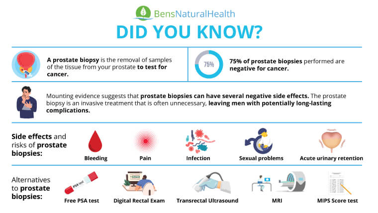 What Percentage of Prostate Biopsies Detect Cancer?