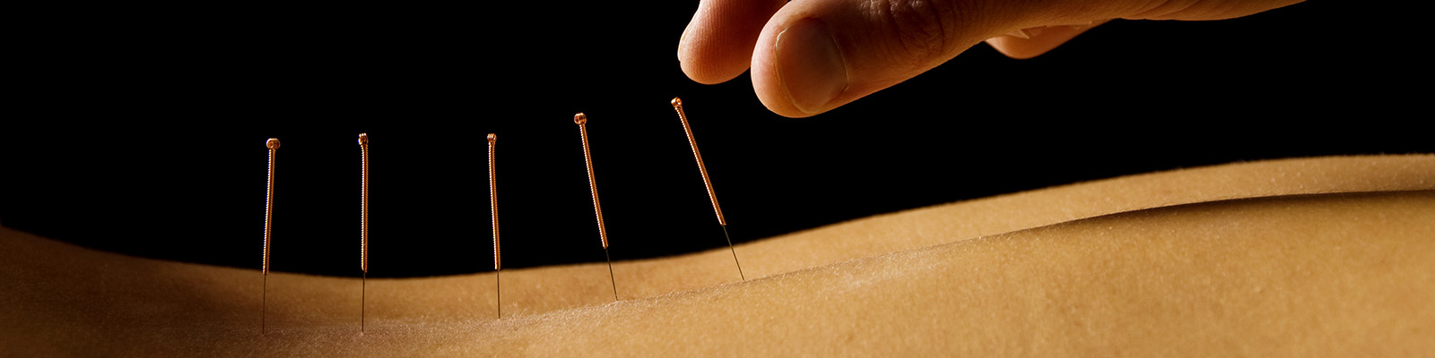 acupuncture-for-chronic-pain-the-science-and-benefits-timenews